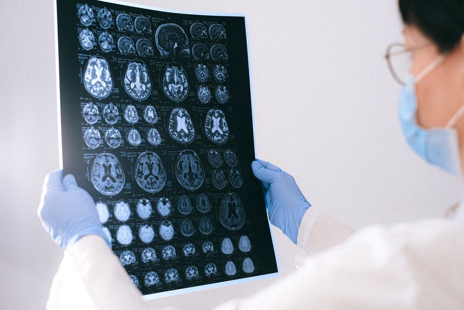 Doctor examining brain MRI scan images